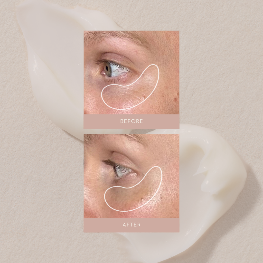 Bioactive Renewal Eye Creme | 10ml
