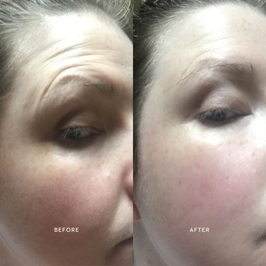 Bioactive Renewal Day Serum | 30ml