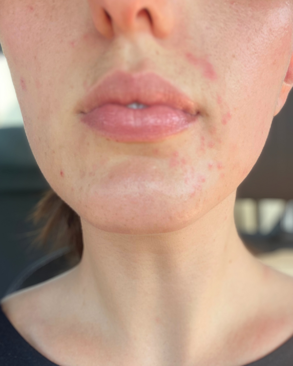 Before photo of Bianca V. Before