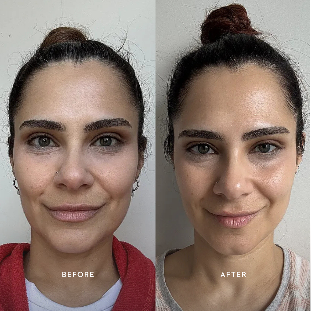 Bioactive Renewal Trio