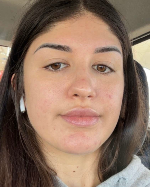 After photo of Hannah
