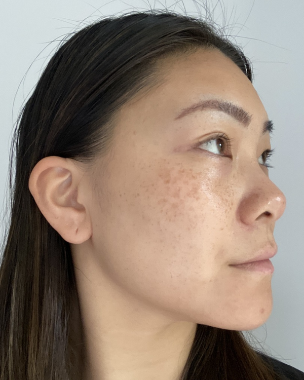 After photo of Karen Week 4