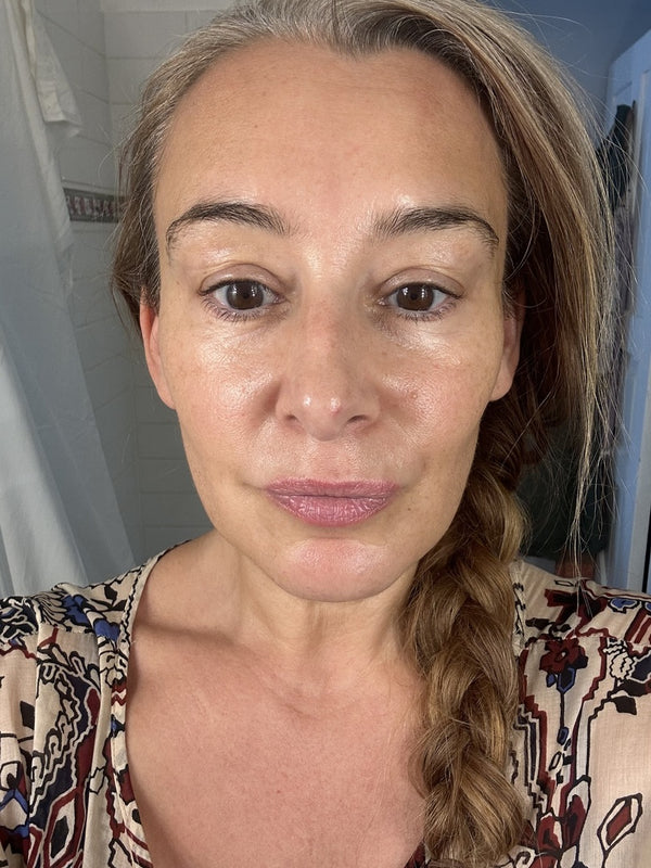 After photo of Linda Week 4