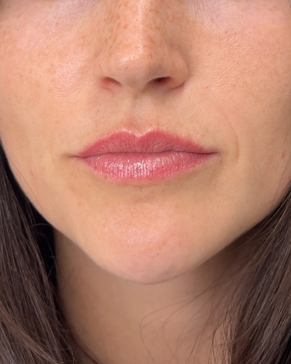 After photo of Jessie After Application