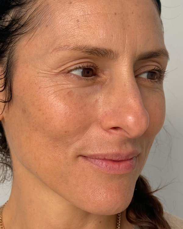 After photo of Carla After Application