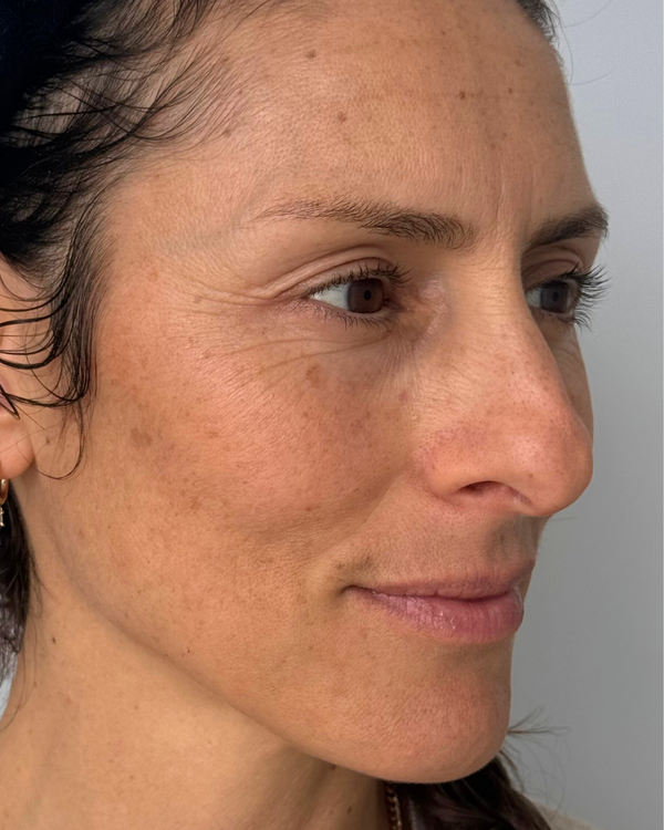 Before photo of Carla Before Application