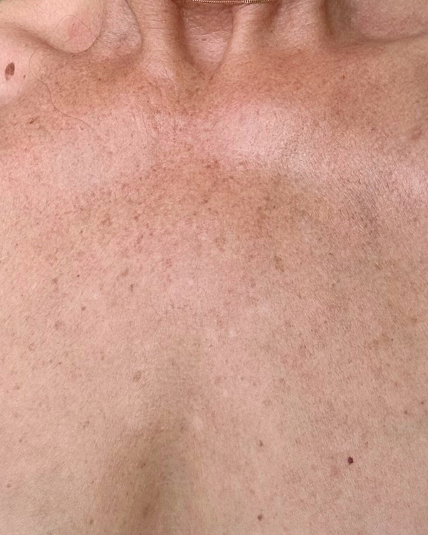 After photo of Toni After application