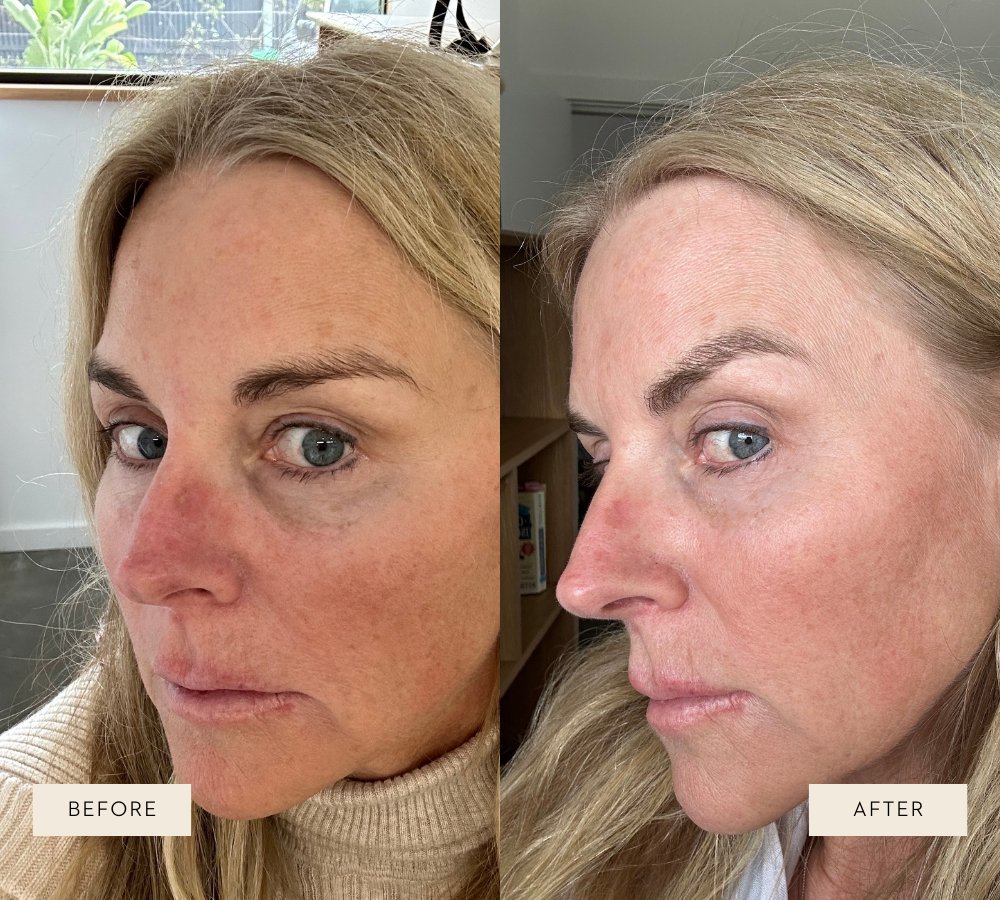 Vitamin A Elixir | 30ml - Mukti Organics