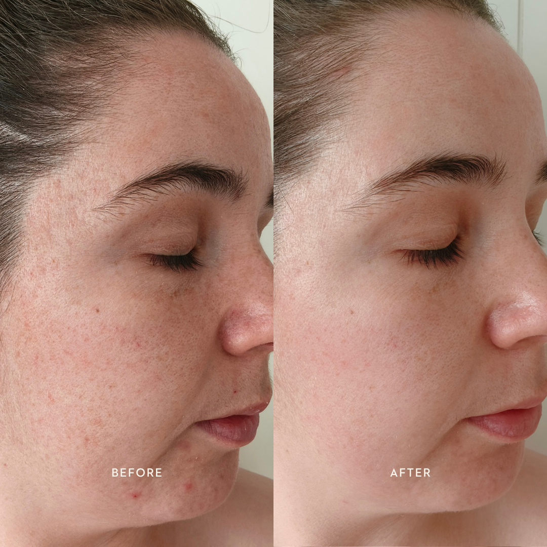 Bioactive Renewal Night Serum | 30ml