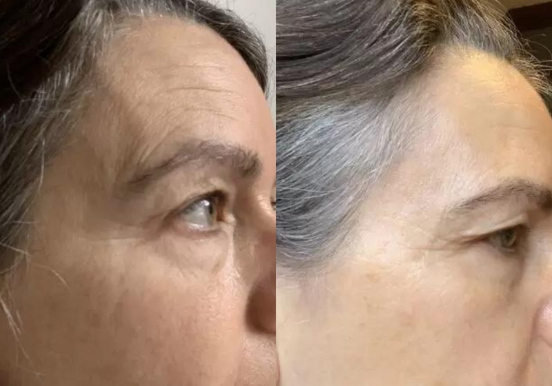 Kết luận về tác dụng của Vitamin C