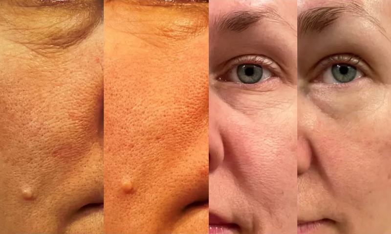 Before-and-after photo highlighting diminished wrinkles and improved skin texture after using an organic skincare treatment