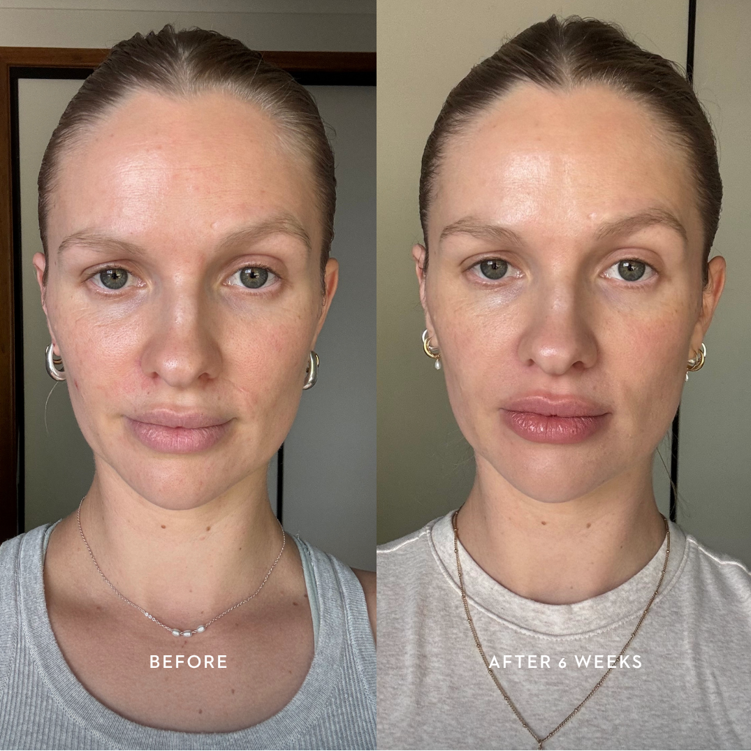 Advanced Bioactive Renewal Collection