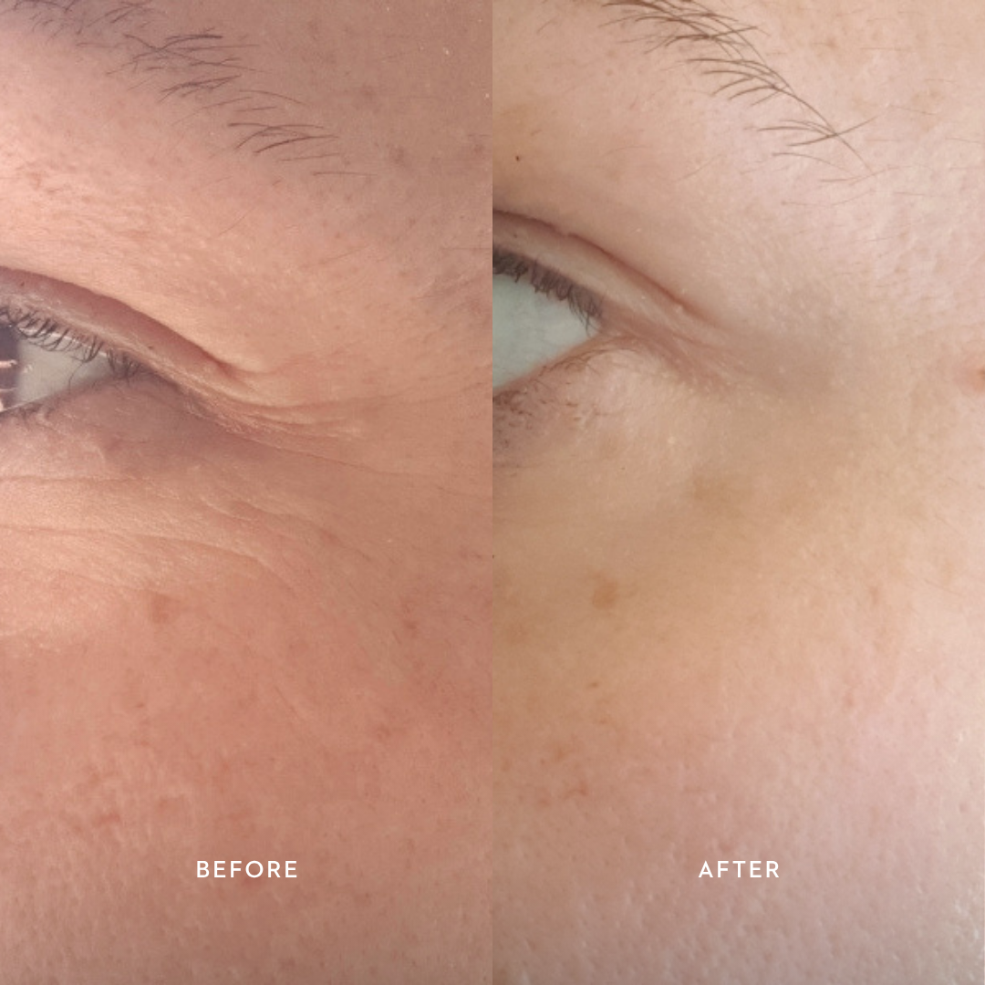Bioactive Renewal Eye Creme | 10ml