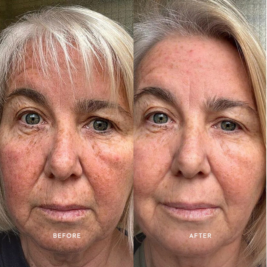 Bioactive Renewal Trio