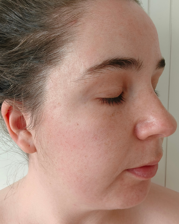 After photo of Chloe 7 Days