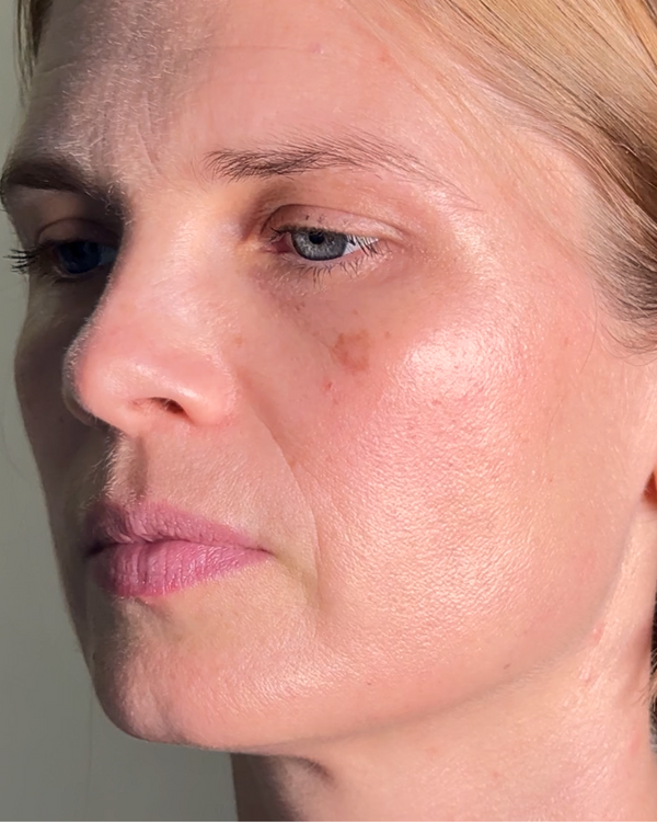 After photo of Belinda After Application