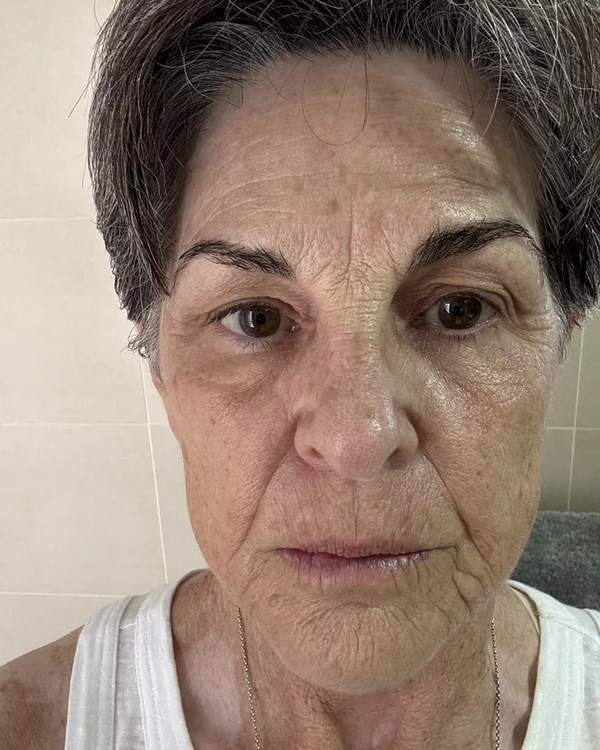 After photo of Debbie 