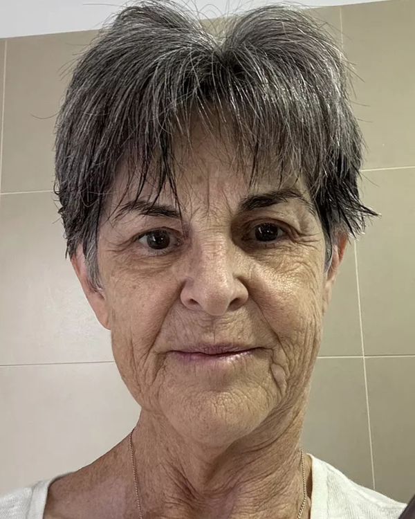 Before photo of Debbie 