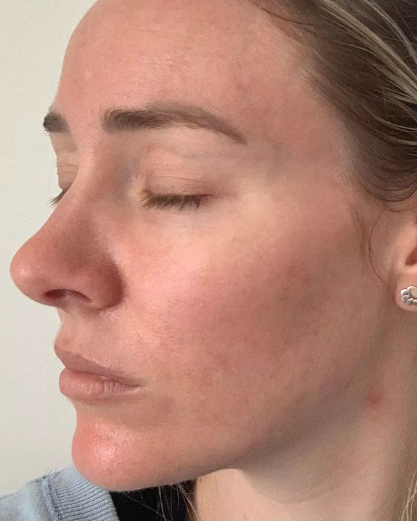 After photo of Kelly Week 4