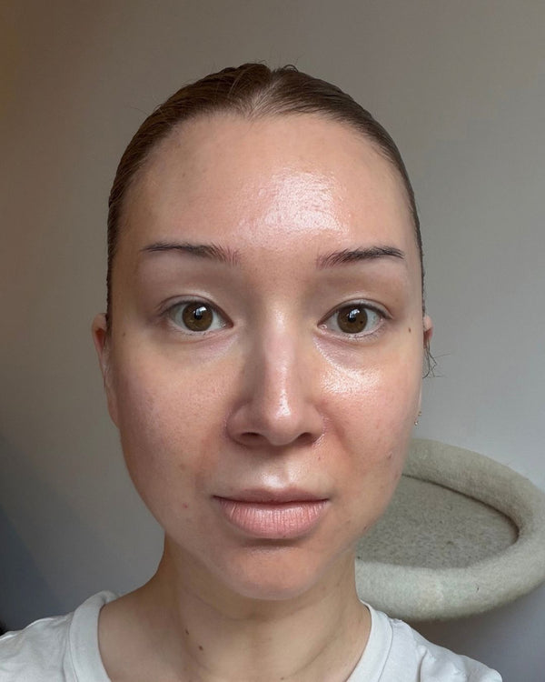 After photo of Kelly After Application