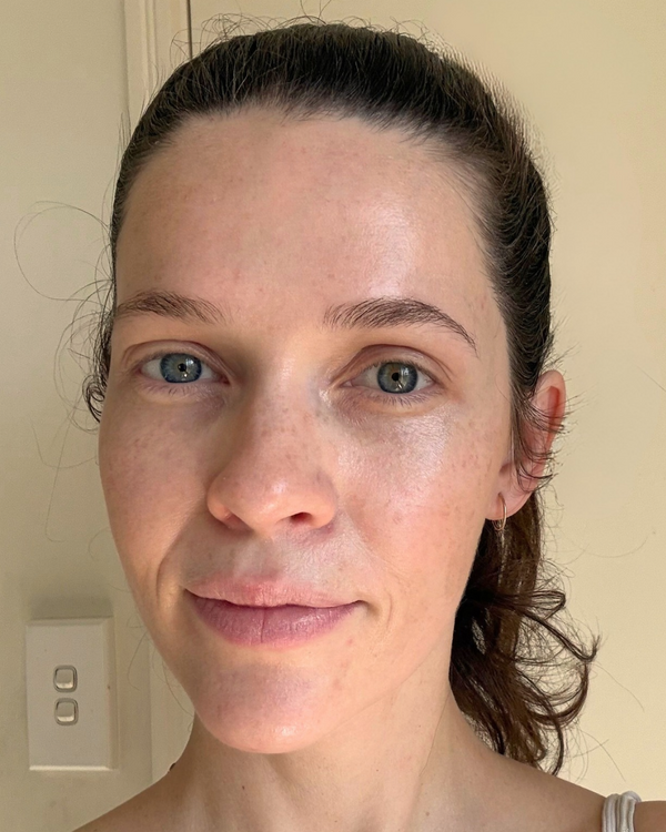 After photo of Kelly After application