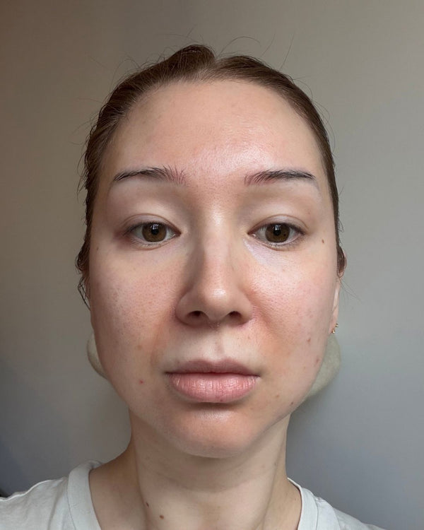 Before photo of Kelly Before Application