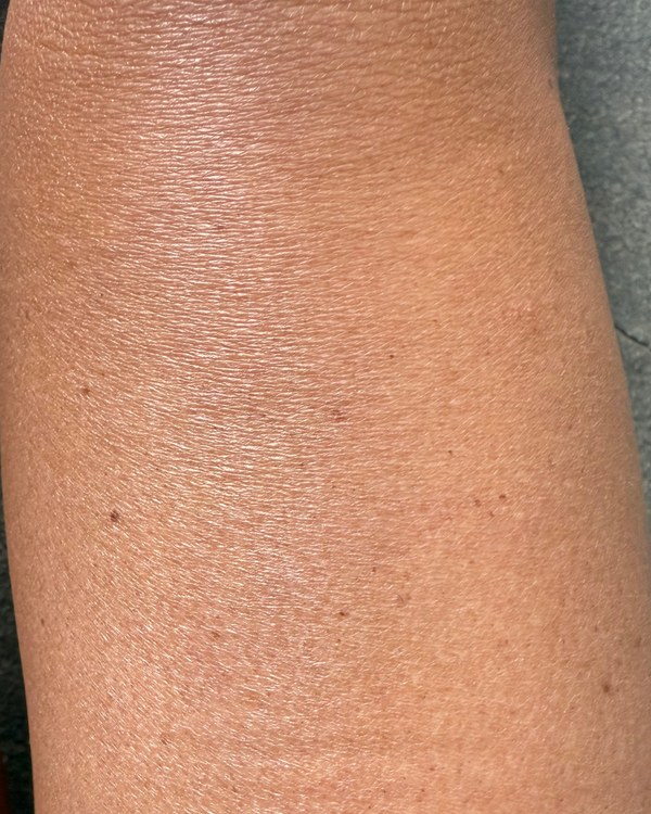 Before photo of Lana Before application