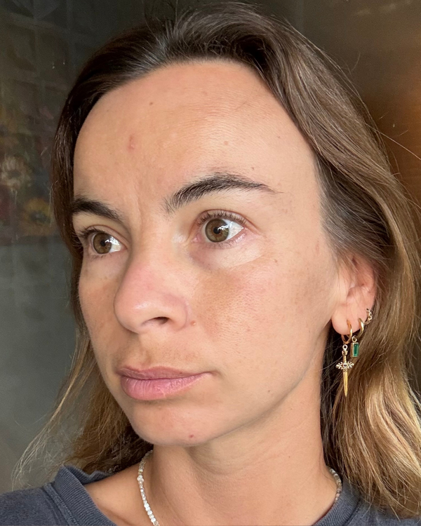 Before photo of Lana Before Application
