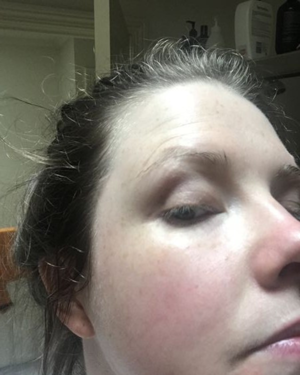 After photo of Lara After