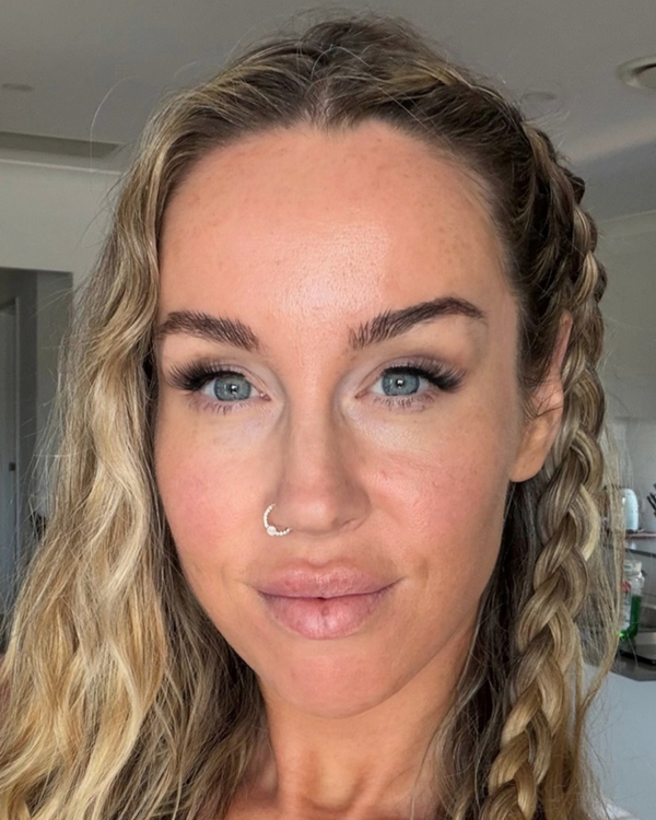 After photo of Laura After application