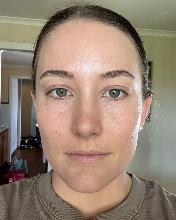 After photo of Laura M. Month 3