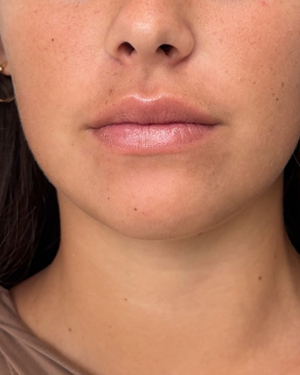 After photo of Amika After Application