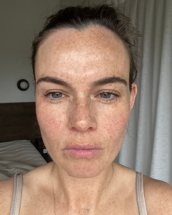 After photo of Ellie Day 1