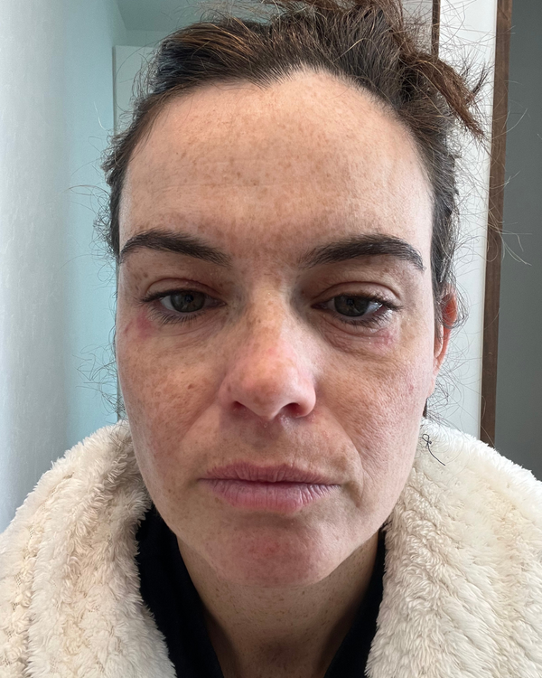 Before photo of Ellie Before