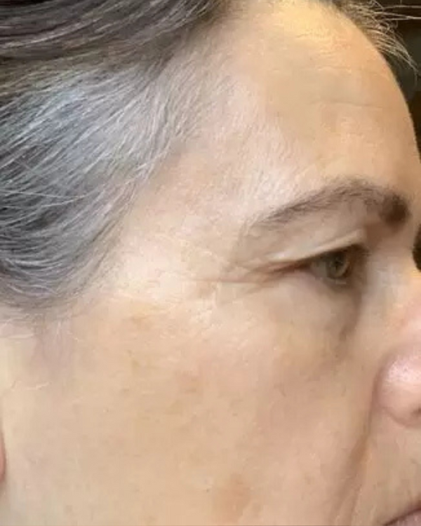 After photo of Monique 
