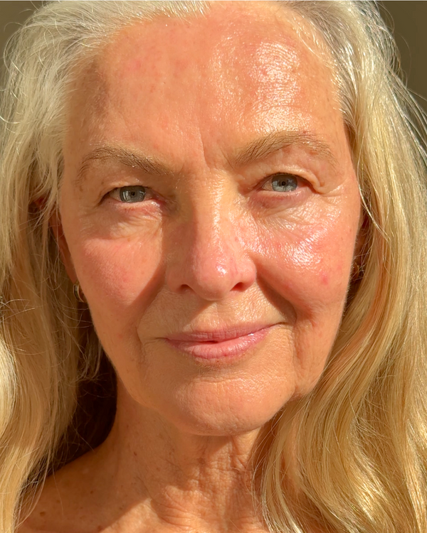 After photo of Illumina After Application