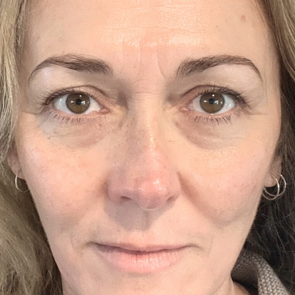 After photo of Fiona C 