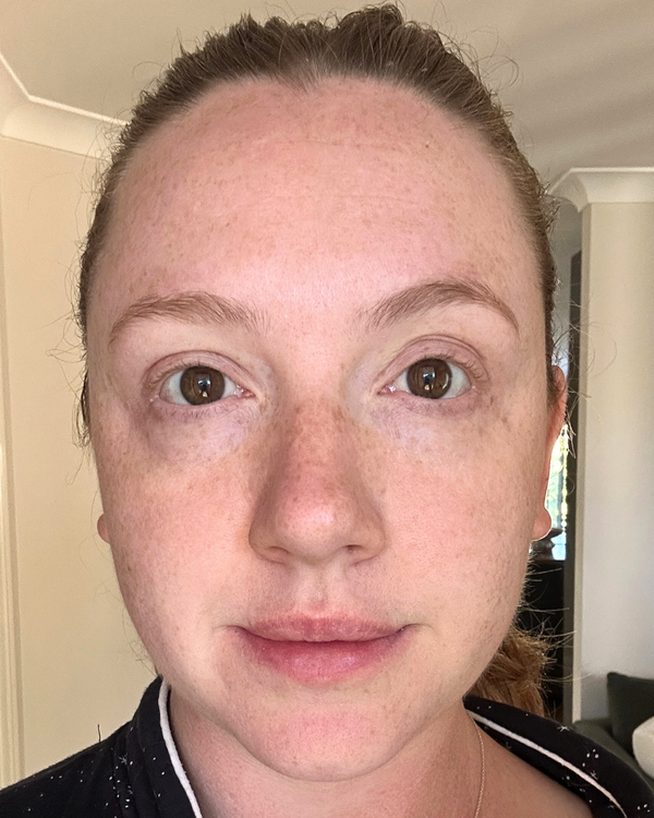 Before photo of Paige Week 1