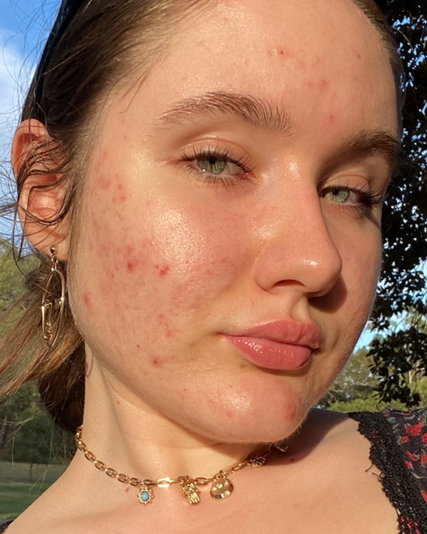 After photo of Patrycja Month 3