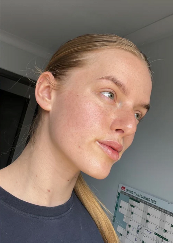 After photo of Sarah Week 10